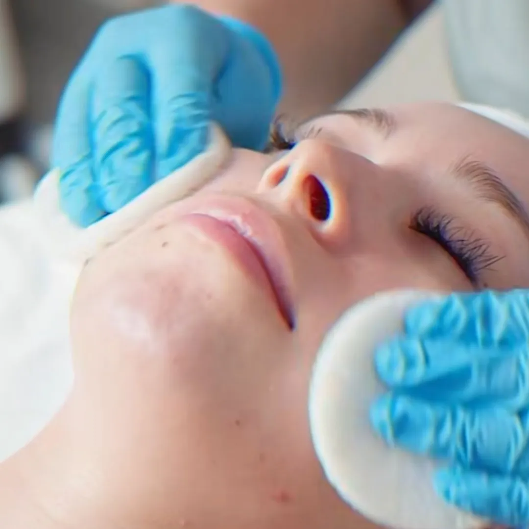 Limpiezas Faciales